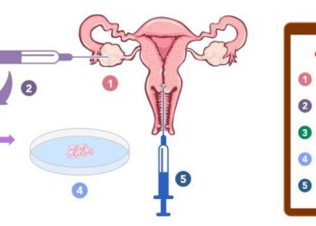 Purpose, Process and Cost of In-vitro Fertilisation Treatment