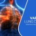Online Vape Shop UK, Voro Vape, Health Tips of Vaping, Vaping and Lung Disease