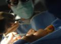 Why Choose An Oculoplastic Surgeon For Eye Surgery