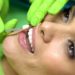 9 Ways to Give Your Veneers Functional Care