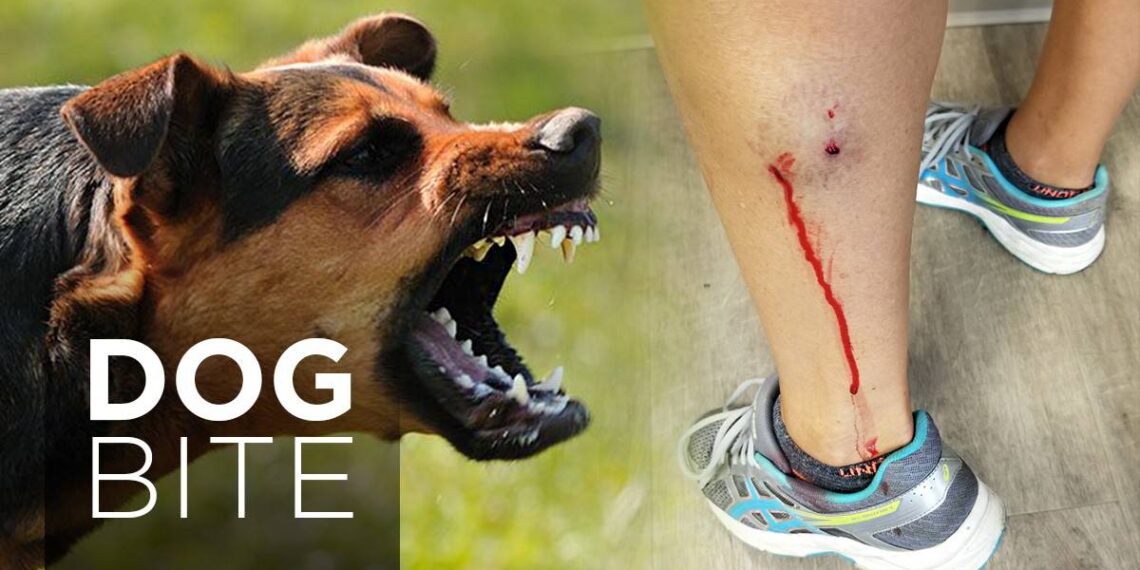 Can I Hire a Personal Injury Lawyer for Dog Injury Bite Claims?